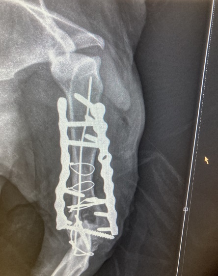 Fraser x ray after web