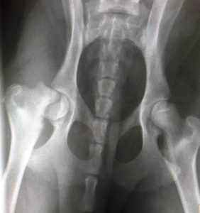 femoral capital physis fracture1